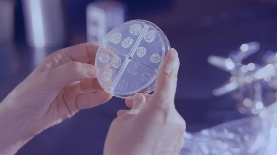 Hadapi Resistensi Antibiotik, Pfizer Perkuat Dukungan terhadap Inovasi Kesehatan