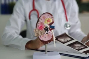 5 Makanan yang Ternyata Diam-diam Memicu Batu Ginjal