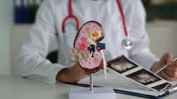 5 Makanan yang Ternyata Diam-diam Memicu Batu Ginjal