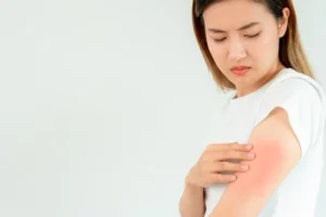 7 Tanda Ginjal Bermasalah, Bisa Terlihat di Kulit