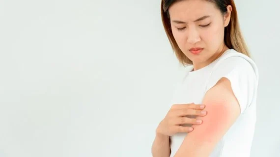 7 Tanda Ginjal Bermasalah, Bisa Terlihat di Kulit