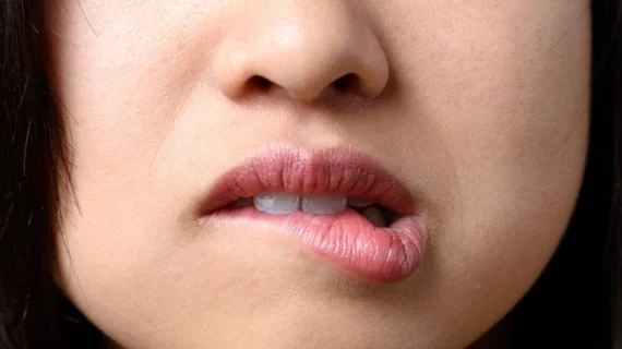 Stop Jilati Bibir! Begini Cara Paling Efektif Atasi Bibir Kering